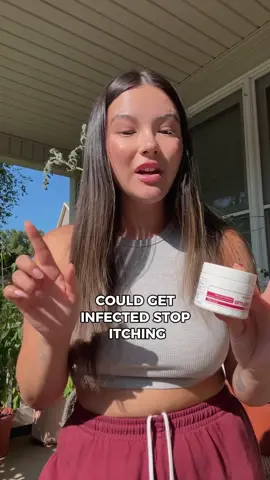When the mosquitos come for you but you come back with THIS 🦟💥 I usually use Emuaid for my dermatitis… but found out it’s amazing on bites too. desperate? yes. worth it? absolutely. #greatforyourskin #goodfortheskin #skincareneeds #emuaid