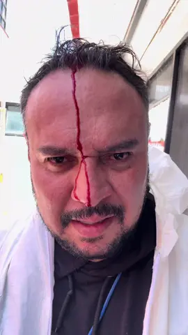 San pu ta zo descalabrada infección #foryoupage #forense #accidents #virus #desinfeccion 