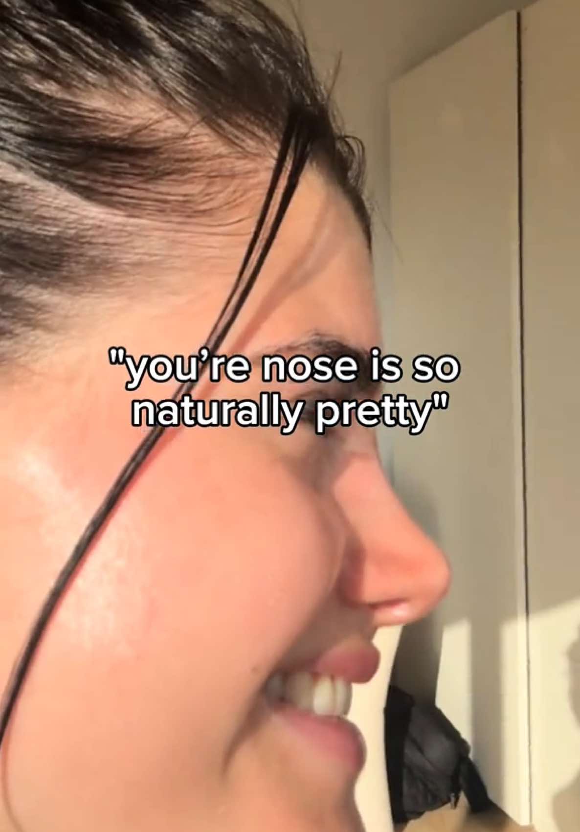it’s pretty yes, but not naturally!! Just being real & showing you that not every nose looks perfect naturally!!  #nosejob #rhinoplasty #beauty #fyp #nose 