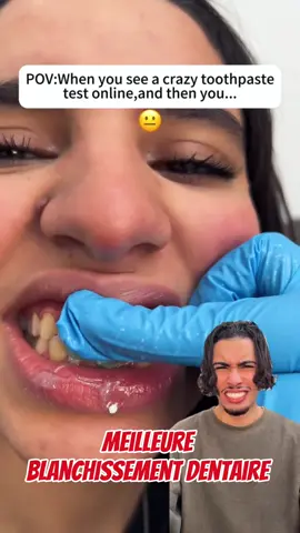 😁 Un sourire blanc, c’est une nouvelle vie ! Avec Body Accel, oublie les dents jaunes et les taches ✨ ✔ Efface les taches de café, thé, tabac et vin ✔ Blanchit rapidement sans abîmer l’émail ✔ Facile à utiliser, résultats visibles dès la 1ʳᵉ semaine ✔ Te donne un sourire éclatant et confiant 🌟 #BodyAccel #DentsBlanches #BlanchimentDentaire #BeautéMali #malitiktok🇲🇱  