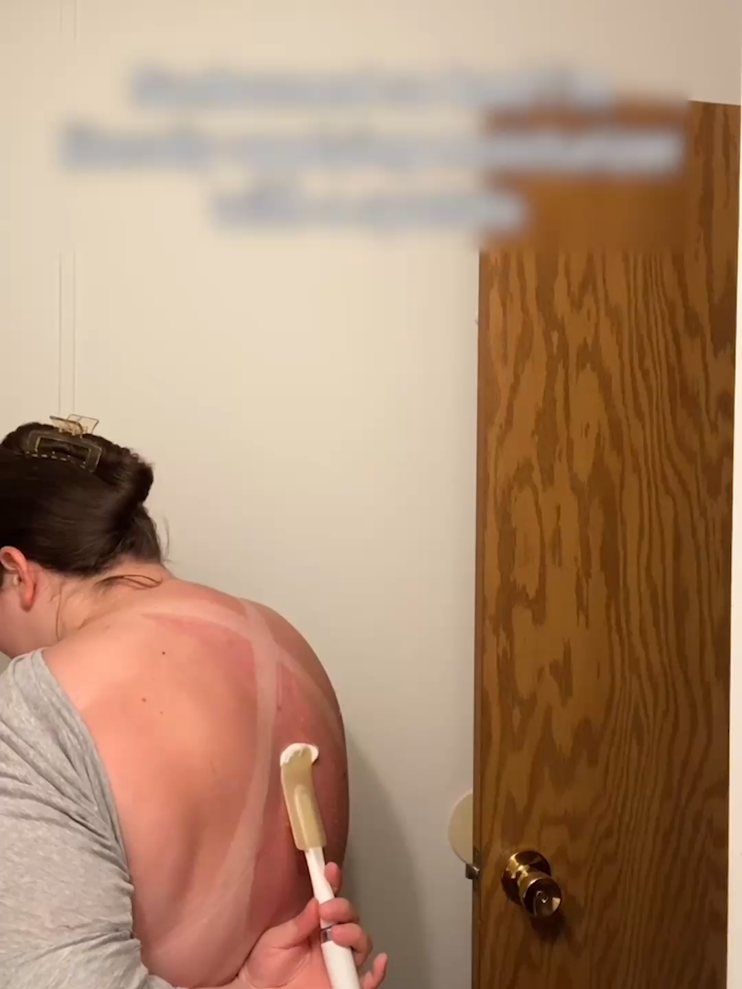 Stay Classy, Grand Haven! 😩 🤣 #puremichigan #sunburn #sunburnrelief #skincare #beachday #summerfun #grandhaven #momfail #fail