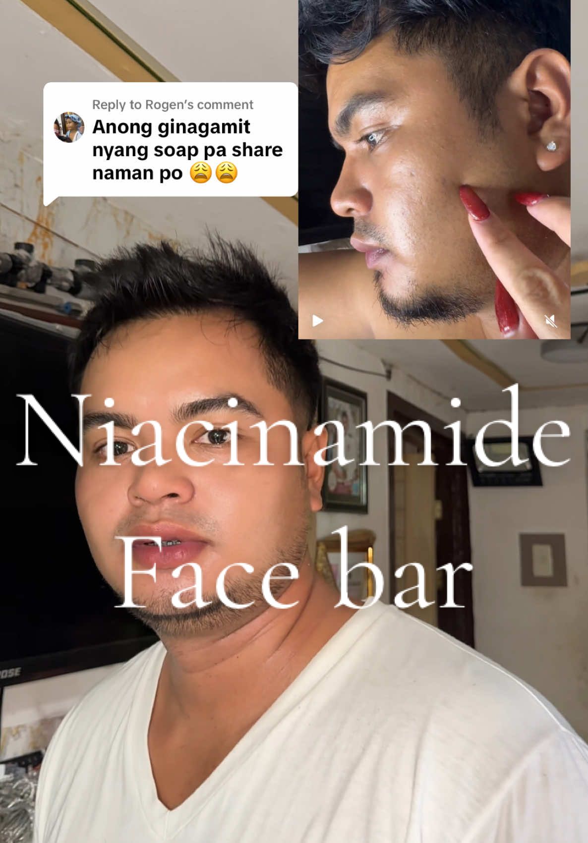 Replying to @Rogen Ang linis tingnan ng face ng asawa ko ngayon dahil sa soap nato 🤭 #dermorepubliq #niacinamidefacebar #niacinamidesoap #acne 