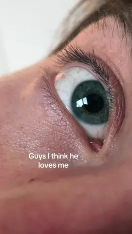 @Greg 