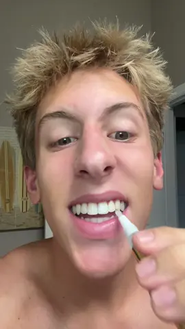 It’s 2025 it’s time to start whitening your teeth #teeth #whiteteeth #whiteningpen #auraglow #fyp