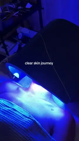 starting my clear skin journey 🫧#clearskin @Aarvica Skin Bar #acne #facial #acneexpert #esthetician 