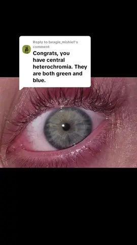 Replying to @beagle_mishief thank you for the imput!! Super cool regardless 🩵💚  #eyecolor  #centralheterochromia #blueeyes #greeneyes 