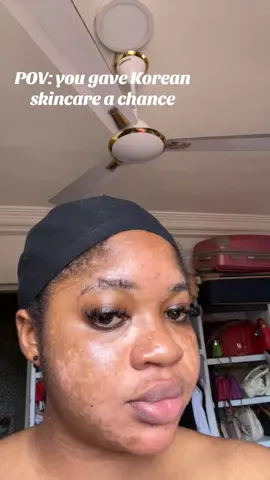 I started using organic skin care and this happened to my face, I nearly mad  thank God to Korean skincare.. 1.You're still using harsh soap on your face Sis, your skin barrier is TIRED. That laundry bar you're using is drying out your face and causing more harm than good. You need a gentle cleanser, not a punishment. 2. No moisturizer = no glow Thinking your oily skin doesn't need moisture? That's the trap. When you skip moisturizer, your skin produces more oil to survive - and the glow you're chasing? It disappears. 3. You're not following a proper routine It's not about having many products. It's about the right ones in the right order. Most girls are just applying cream randomly and hoping for a miracle. But glow comes from strategy - not guesswork. - I teach the exact skincare routine that helped me (and my girls) glow without bleaching, filters, or expensive products. Want the full routine that actually works? I sell everything skin care products at affordable prices DM me 