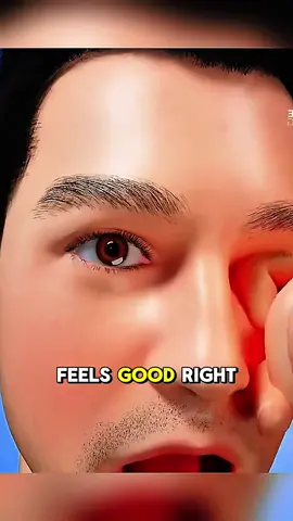 Why Rubbing Your Eyes Is Dangerous - 3D Animation Hashtags: #EyeHealth #RubbingEyes #VisionCare #3DMedicalAnimation #MedicalAnimation CTA: “Do you rub your eyes without thinking? Comment below, follow for more, and share with 5 friends to spread awareness!”