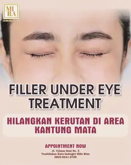 Kerutan halus di area kantung mata bikin kamu terlihat lebih tua. Hilangkan kerutan di area kantung mata dengan *Filler Under Eye Treatment* Yuk konsultasikan problem dan treatment yang cocok untuk kulit mu di dr. Mira Skincare check alamat & no admin kita ada dibawah ini ya ! happy treatment ! Alamat : Jl. Trimas Seni No.03 ( dr.Mira ) No Admin: 0823824127000 Konsultasi Gratis setiap melakukan perawatan/pembelian produk skincare apa saja #drmiraskincare #skincaretbh #laserco2 #laserfractional #klinikkecantikantembilahan                      