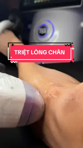 🔥 TRIỆT LÔNG CHÂN – MỊN MÀNG TỰ TIN NGAY TỪ BUỔI ĐẦU 🔥 Đừng để những sợi lông chân cứng đầu khiến bạn mất tự tin khi diện váy ngắn hay bikini. Công nghệ triệt lông lạnh hiện đại tại TSS Glow-Lab giúp loại bỏ tận gốc lông rậm, mang lại làn da sáng mịn – láng o chỉ sau vài buổi. ✅ Không đau rát – không bỏng da. ✅ Lông thưa dần, mịn màng lâu dài. ✅ An toàn, phù hợp cho mọi loại da. Đặc biệt, giá chỉ 149K/buổi, quá rẻ để sở hữu đôi chân mịn màng mà bạn hằng mong ước! 🌸 💌 Inbox ngay hôm nay để giữ lịch và nhận ưu đãi siêu hot – số lượng có hạn. #spa #viral #trietlong #fyp #tssglowlab 