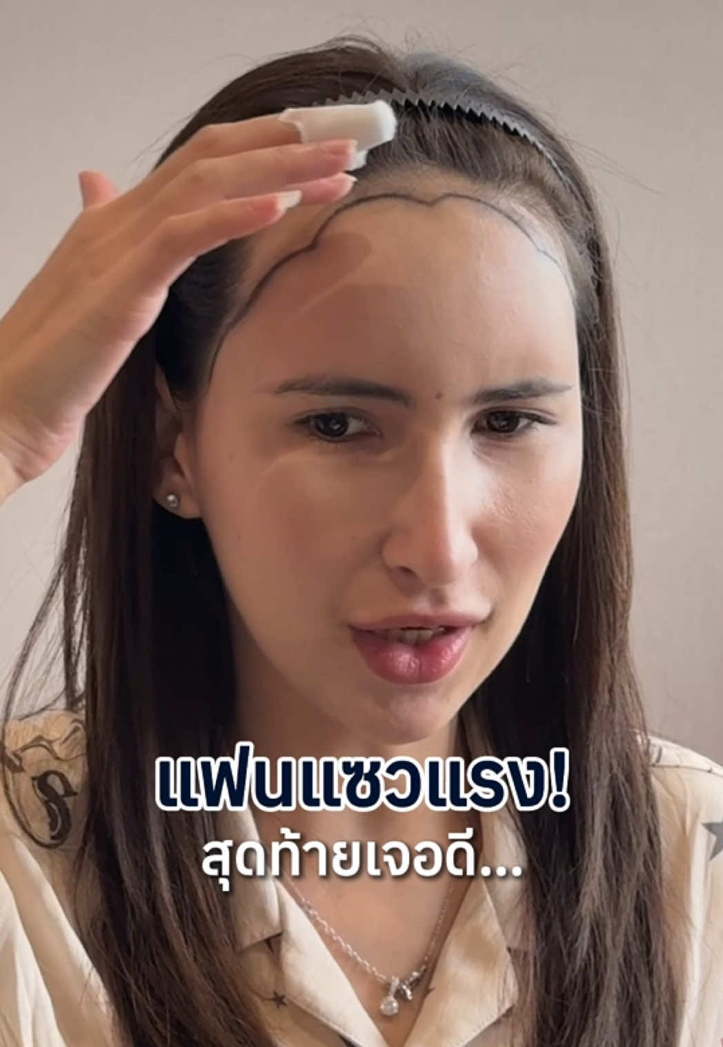 แฟนแซวแรง…สรุป เปย์ฉ่ำ 😳✨#รีวิวปลูกผมHairClinique #HairCliniquebySLC #BeYourBestSelf  #คลินิกดูแลเส้นผม #รีวิวปลูกผมSLC             