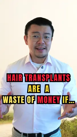 How to waste money with a hair transplant for guys with advanced hair loss…. Watch this before you decide on a procedure #money #hair #fue #HairLoss #DrAly 