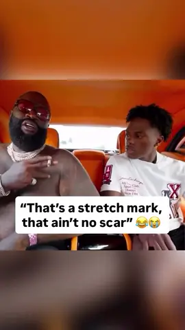 Rick Ross reaction after Speed called his scars stretch marks 😂