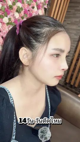 อัพเดทการเสริมจมูกจากวันแรกถึงปัจจุบัน#ขึ้นฟีดเถอะ #แท่งแรกในชีวิต #เสริมจมูก #จิรกรคลินิกสาขาพัทยา @จิรกรคลินิกเวชกรรมสาขาพัทยา #จิรกรคลินิกเวชกรรม 