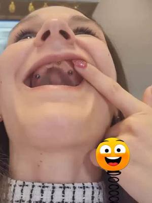A venda anual de implantes dentários chegou!