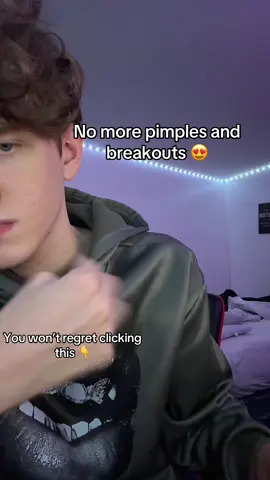 I would 🤷‍♀️ #acnetreatment #acne #skincare #pimples #skinhacks 
