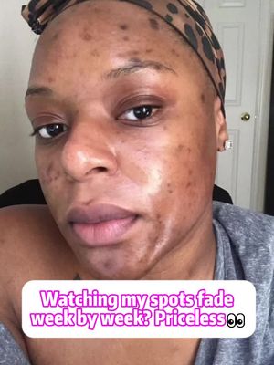 It's time to get rid of your spots