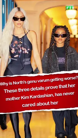 Why is North's genu varum getting worse? These three details prove that her mother Kim Kardashian, has never cared about her#fyp #foryou #north #kim #kimkardashian 