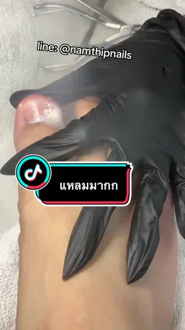 💓 #namthipnails #ตัดเล็บขบ #ตัดหนัง #ทำเล็บ #ร้านตัดเล็บขบ      Fb : namthipnails  Line : @namthipnails  นัมเบอร์วัน8 ตลาดม.ราม2  กทม  Map: namthipnails  https://goo.gl/maps/JmwpCKLfKwmhKGK96  ร้านเปิดทุกวัน เวลา12.00น-22.00น.