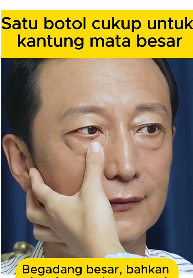 Masih bingung cara menghilangkan kantung mata? Coba krim mata retinol, dijamin ampuh! ✨#eyecream #eyebags #skincare #foryou #darkcircles 