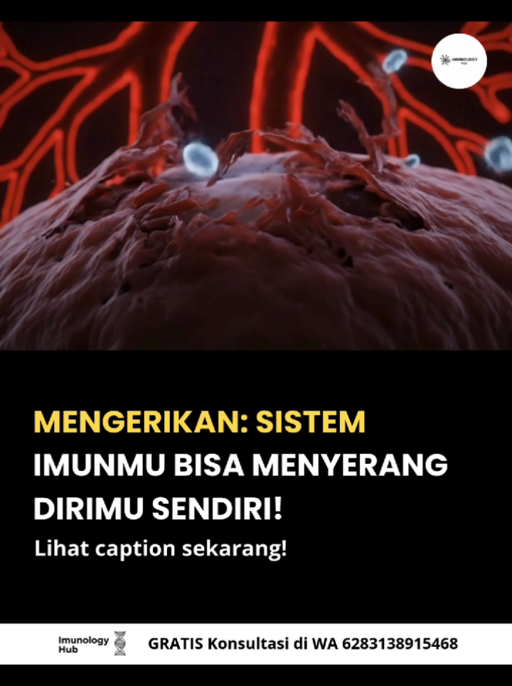 Pernahkah kamu membayangkan tubuhmu sendiri bisa menjadi musuh terbesar?  Sistem imun, yang seharusnya melindungi, kadang justru menyerang jaringan sehat tubuh. Dalam penyakit autoimun, sel imun bisa menghancurkan paru-paru, jantung, sendi, bahkan saraf—serangan ini sering terjadi tanpa gejala, sehingga banyak orang tidak menyadari tubuhnya sedang ‘berperang dari dalam’. Mengapa bisa terjadi? Faktor genetik, stres, polusi, dan ketidakseimbangan sistem imun bisa memicu tubuh menyerang dirinya sendiri. Sel imun bergerak seperti tentara yang keliru menembaki markasnya sendiri, perlahan merusak organ vital tanpa ampun. Akibatnya, paru-paru terbakar, jantung berdetak tak menentu, sendi melemah—semuanya bisa berlangsung diam-diam. Waspada! Tubuhmu bisa menjadi medan pertempuran yang tak terlihat. Menjaga kesehatan, memperkuat sistem imun, dan memantau kondisi tubuh secara rutin adalah kunci untuk melindungi diri. 💡 Jangan tunggu sampai terlambat! Konsultasikan kesehatanmu sekarang melalui WA 083138915468 dan follow kami untuk fakta medis serta tips menjaga tubuh dari serangan internal!