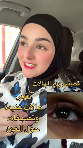 ⁨	⁨	شون حليت مشكلة الهالات الي عندي والي هو كابوس كان بالنسبة الية صراحة لكن الحمدلله هسه احسن بهوااااي وصرت اخلي واقي بس واطلع بعد ماكنت احتار شخلي من كونسيلر وطبقاااات حتى اخفي الهالات وكانت بالعكس تصير لونها ازرق😔 بعض الامور الي التزمت بيها الي ساعدتني بتخفيف الهالات ايضاً:  تدليك المنطقة عند وضع الهايلرونك اسد ووخلي على بشرة رطبة مو جافة 👌 شرب مااااء كثير👌 التزمت بالكريم من صدك يعني كل يوم اخلي منه 👌 التزم بنوم ٨ ساعات ومرات اكثر 👌 مااشرب لا كهوة ولا جاي 👌 وانتو حتى تحصلون على نتيجة لازم تتابعوني وتسمعون الكلام😊😍 وانتو شنو سويتو حتى تخلصتو من الهالات؟ اذكرو تجاربكم 🥰🥰 بتعليقات 👇🏻 . . #كربلاء #هالات_سوداء #اكسبلور⁩⁩ #عناية_بالبشرة 