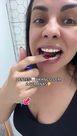 Dentes amarelos? Só vai ficar se você quiser #dentes #dentesbrancos #dentesbrancos 