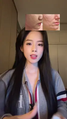 #minzystory #trimun #chammun #chuamun #munviem 