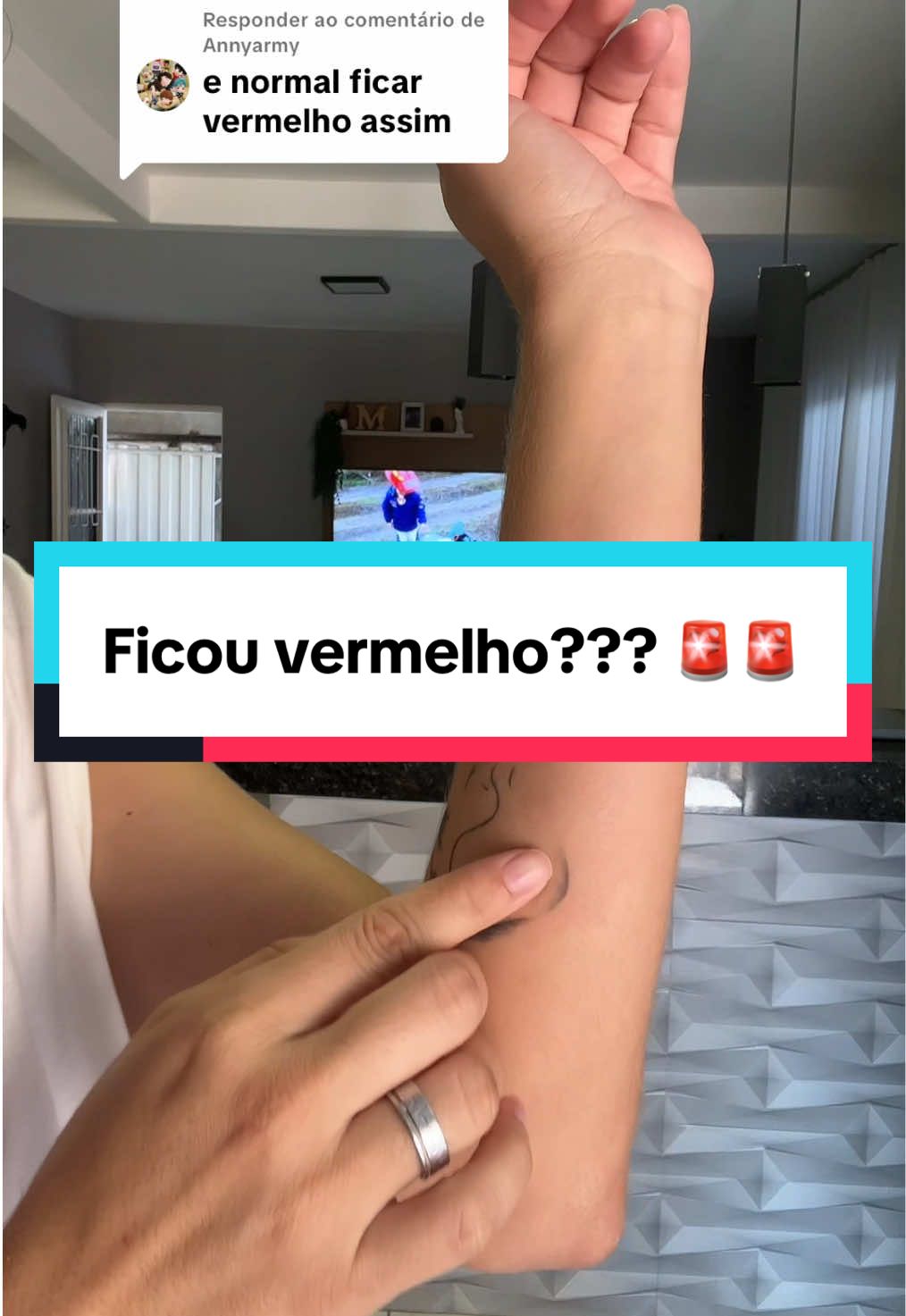 Respondendo a @Annyarmy minha pele ficou vermelha e esquenta, será que é normal? #cremerosa #adeus #fyp #tratamento #cuidadoscomapele 