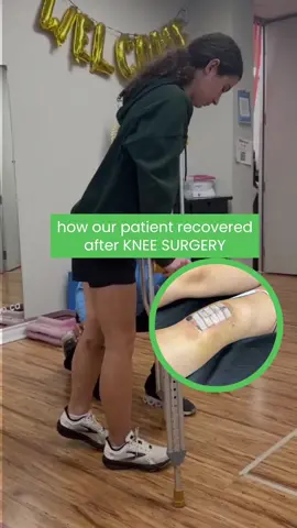 From surgery to strength 💪 Recovering from an ACL tear isn’t easy — but with the right physio care and consistent effort, getting back on your feet is possible. Watch how determination and guided rehab turned struggles into real progress. Start your recovery journey with us today. #fyp #fypシ #ACLRecovery #PhysiotherapyClinic #TorontoPhysio #PickeringPhysio #KneeRehab #InjuryPrevention #SportsPhysio #KneeRecoveryJourney #HealingInMotion