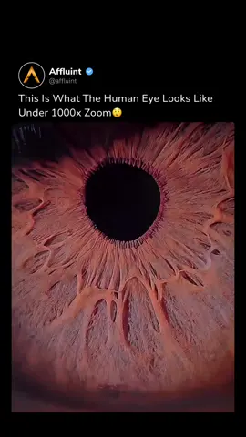 What the Eye Looks Like at 1000x Zoom🔎👁️ At this magnification, you’re not just seeing iris patterns, you’re looking at the cellular level. Structures like corneal cells, nerve fibers, capillaries, and even photoreceptors become visible, offering a research-level view far beyond standard eye exams. Enjoy this content? Follow us @affluint⭐️ Media: @mt_eye_care/IG  #eye #doctor #science #technology #cool 