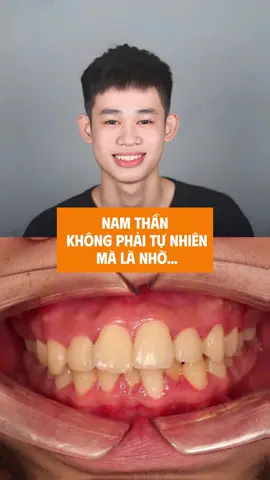 Đẹp tự nhiên nhưng không tự nhiên mà đẹp😎 #niengrang #nhakhoavananh #xuhuong #nhakhoauytin #niengrangbacninh 