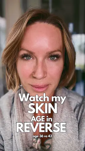 Absolutely BONKERS! Pre Pomifera vs Post.  To be noted in the 36yo pictures I had already getting Botox for nearly a decade and had done filler a handful of times.  My skin still looked tired, textured, dull and saggy.  Fast fwd through several years of Pomifera/YOUTH products used consistently and the difference is ASTONISHING! Do I still get Botox? Yes.  Do I still get filler? I have but not in a few years.  The only thing that’s “new” that I didn’t do back in my 30’s (aside from Pomifera) is now I get a yearly LaseMD laser treatment.  I’ve not had it done yet this fall though.  It’s NEVER too late to start a good, affordable, CLEAN skincare routine that WORKS. FOLLOW for more.  And please RESHARE with your friends 😘 LINKS in comments! 𝓍ℴ𝓍ℴ ℳ~  ** ps. Pomifera also has a 30day $$ back guarantee (but you won’t need it😉)