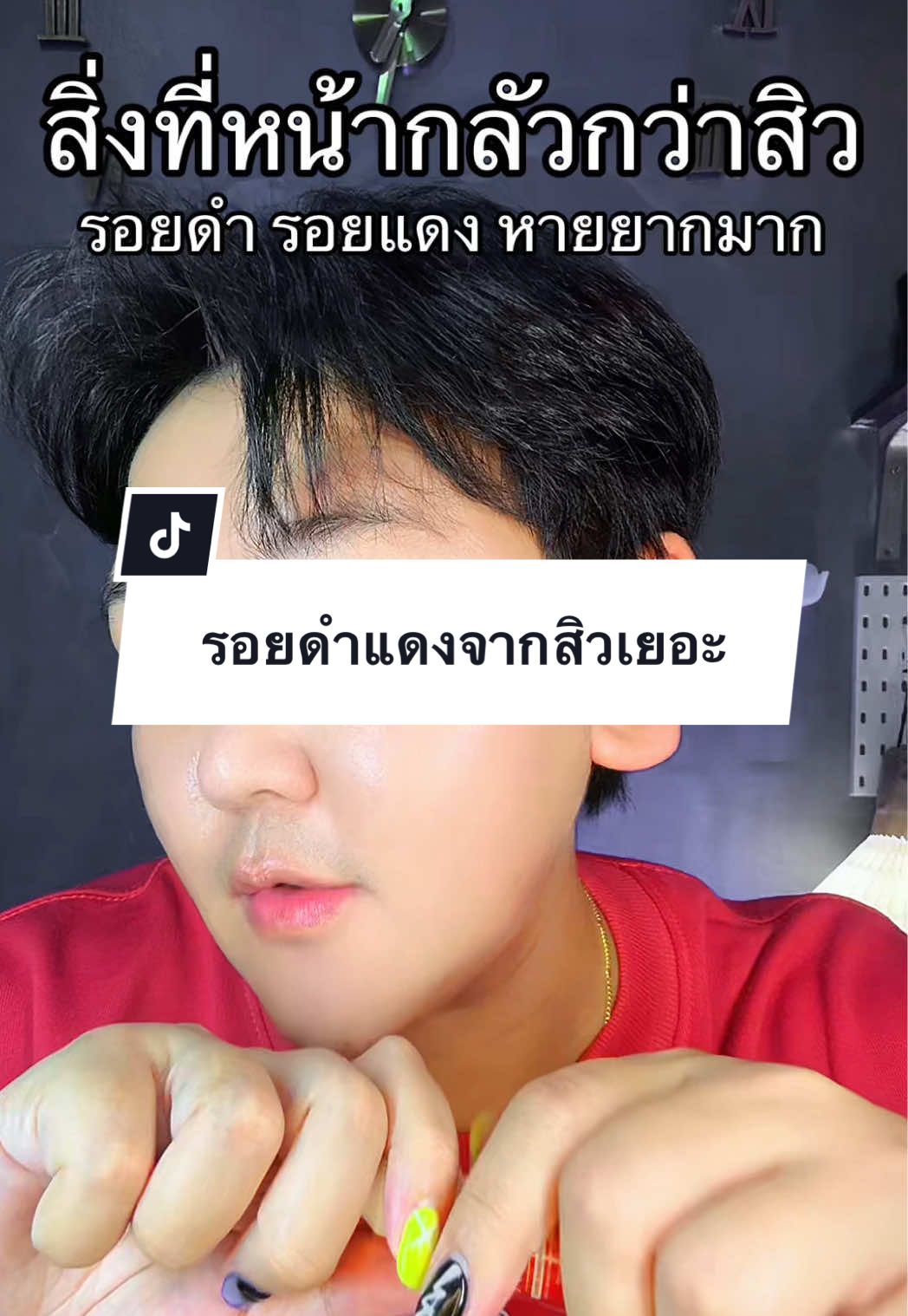 ตอบกลับ @user3152249594437 ใช้เช้าก่อนนอนอย่างต่อเนื่องได้เรย #เมดิต้าตัวลดรอยสิว #รอยดําจากสิว #รอยแดงจากสิว #เมดิต้า #medita 