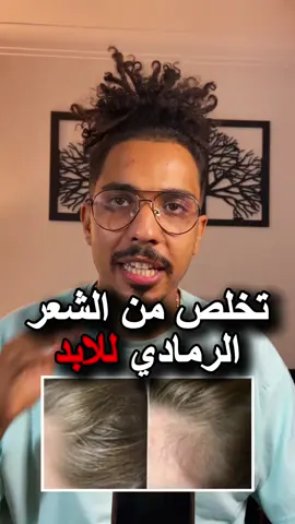 وصفة طبيعية لمحاربة الشيب: بيضة غنية بالبيوتين، شاي أسود يغمّق الشعر طبيعياً، وزيت خروع ينشّط الدورة الدموية ويقوي الشعر. مزيج سهل وبمكونات متوفرة يعيد لشعرك الحيوية واللمعان.