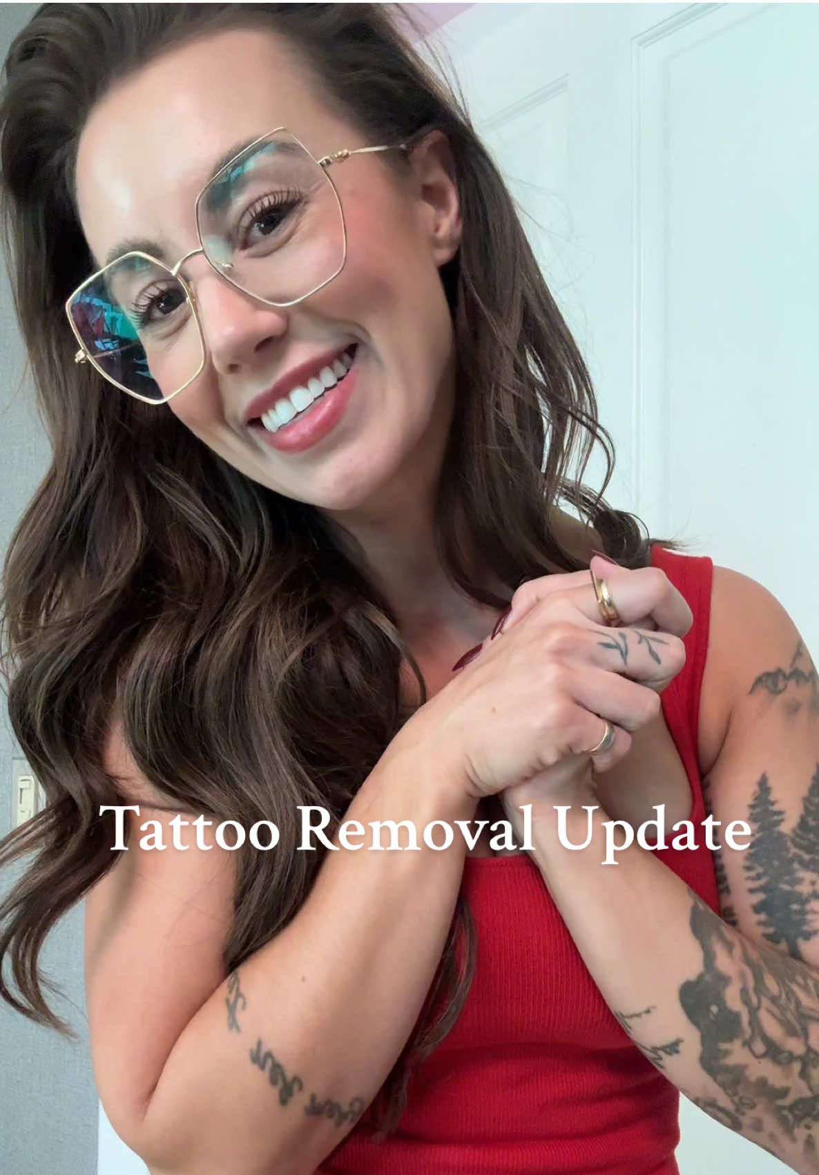 Second laser tattoo removal appointment is done! @removery #tattooremoval #removery #ad 