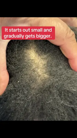 Catch hair loss at its early stage . 