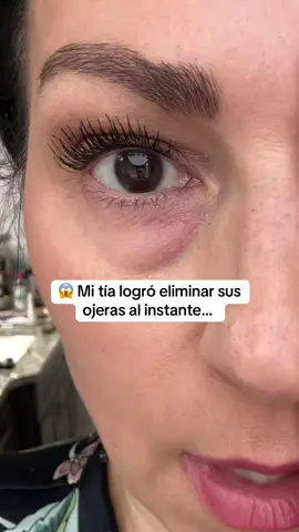 🚨 2x1 Exclusivo HOY.  Recupera tu mirada fresca y segura