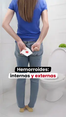 🍑 Molestias al sentarte, picazón o sangrado al ir al baño... Podrían ser hemorroides. 📍 Internas: dentro del recto, pueden sangrar sin dolor. 📍 Externas: fuera del ano, suelen doler más. 🩺 ¡No normalices el malestar! Consulta y trata a tiempo #hemorroides #hemorroidesexternas #saludbienestar #DetecciónTemprana #tiktoksalud 