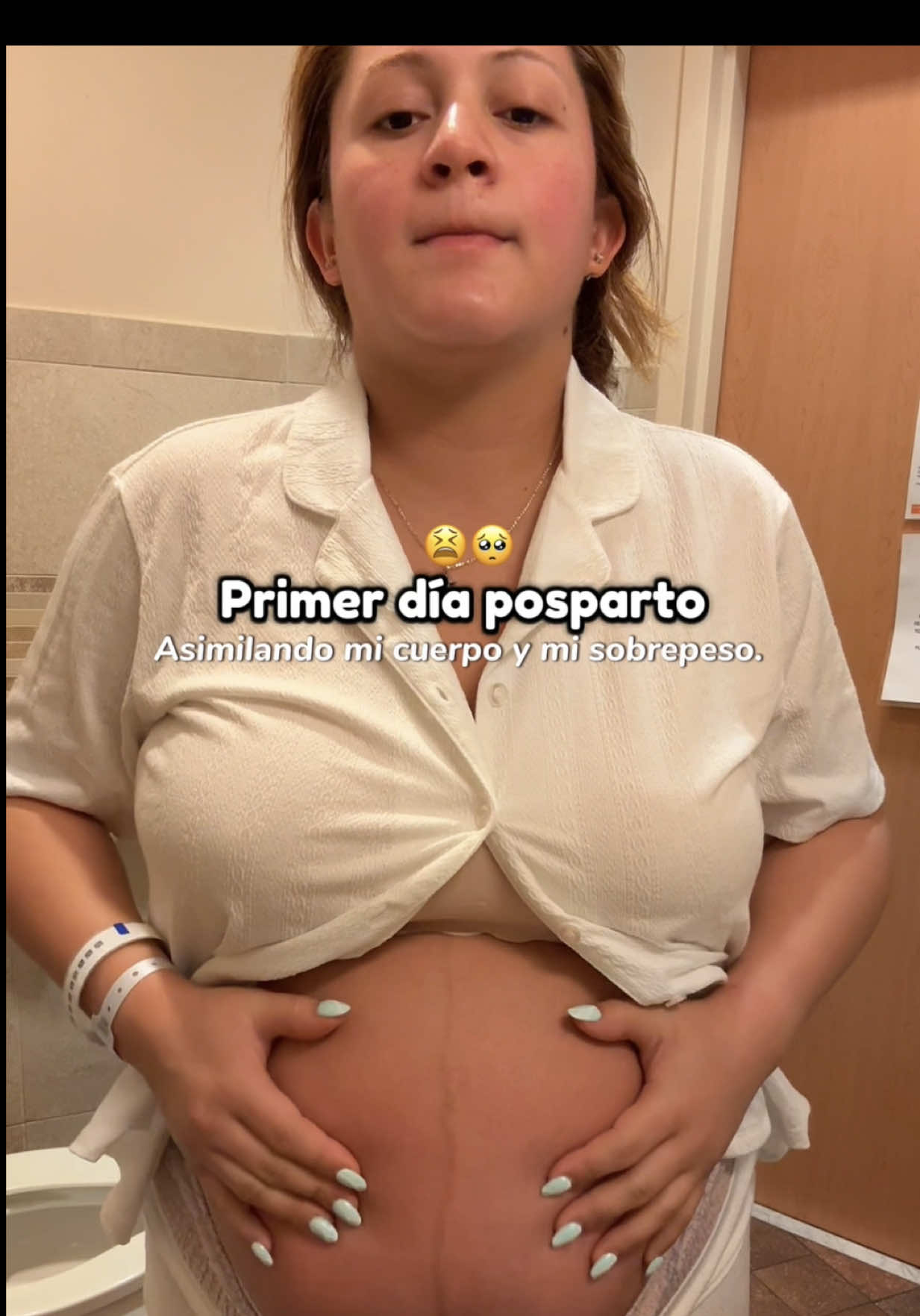 Dude mucho en subir este video, pero me atreví ya que no mostramos la realidad de cómo quedamos después del parto y de la manera que nos sentimos😫 tu cuerpo está hinchado, no reconoces tu reflejo y muchas veces la tristeza se apodera de ti.  Yo también me sentí así😣:  con sobrepeso, desanimada y pensando que nunca volvería a verme bien.🥺 El posparto puede llevarnos a la depresión si nos enfocamos solo en lo que no nos gusta. En lugar de castigarnos, podemos transformar esa energía:  empezar con pequeños cambios, un poco de movimiento en casa o en el gimnasio, una caminata, alimentarnos mejor y, cuando sea posible, dedicar tiempo a nosotras💅🌸💪🏼. Hoy, después de dos meses de esfuerzo, me miro al espejo y veo una mujer diferente.🥹 No solo por haber bajado de peso, sino porque me demostré a mí misma que sí podía💪🏻 Que aunque los primeros días son los más duros, todo es posible si nos lo proponemos.🙌🏼 A ti, mamá que me lees: no te deprimas, no te castigues❤️‍🩹 Tu cuerpo es fuerte, dio vida, y merece amor y paciencia.  No importa en qué etapa estés, cada paso cuenta y cada día es una oportunidad para sentirte mejor contigo misma. 🍼❤️🤱🏼 tú también puedes!!! No te compares, ve a tu ritmo, y nunca olvides que no estás sola.🩷 #PostpartoReal #MamáFuerte #MotivaciónPosparto