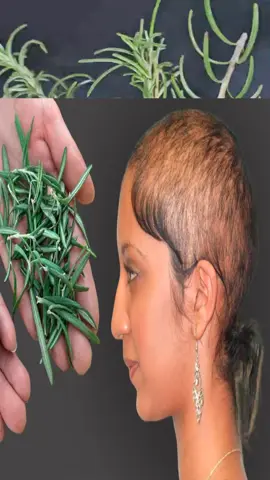 Koreanische Ärzte haben meine Glatze mit diesem Rezept geheilt! Meine Haare wachsen wie verrückt #haarausfall #beautyrecipesheal #bockshornklee #gegenhaarausfall #hairgrowth 