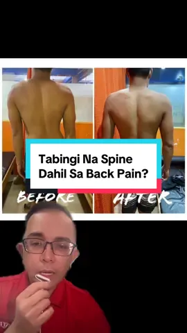 Tabingi Na Spine Dahil Sa Back Pain?