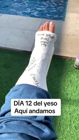Día 12 Yeso #paratiiiiiiiiiiiiiiiiiiiiiiiiiiiiiii  -#teamyeso  #fracture 