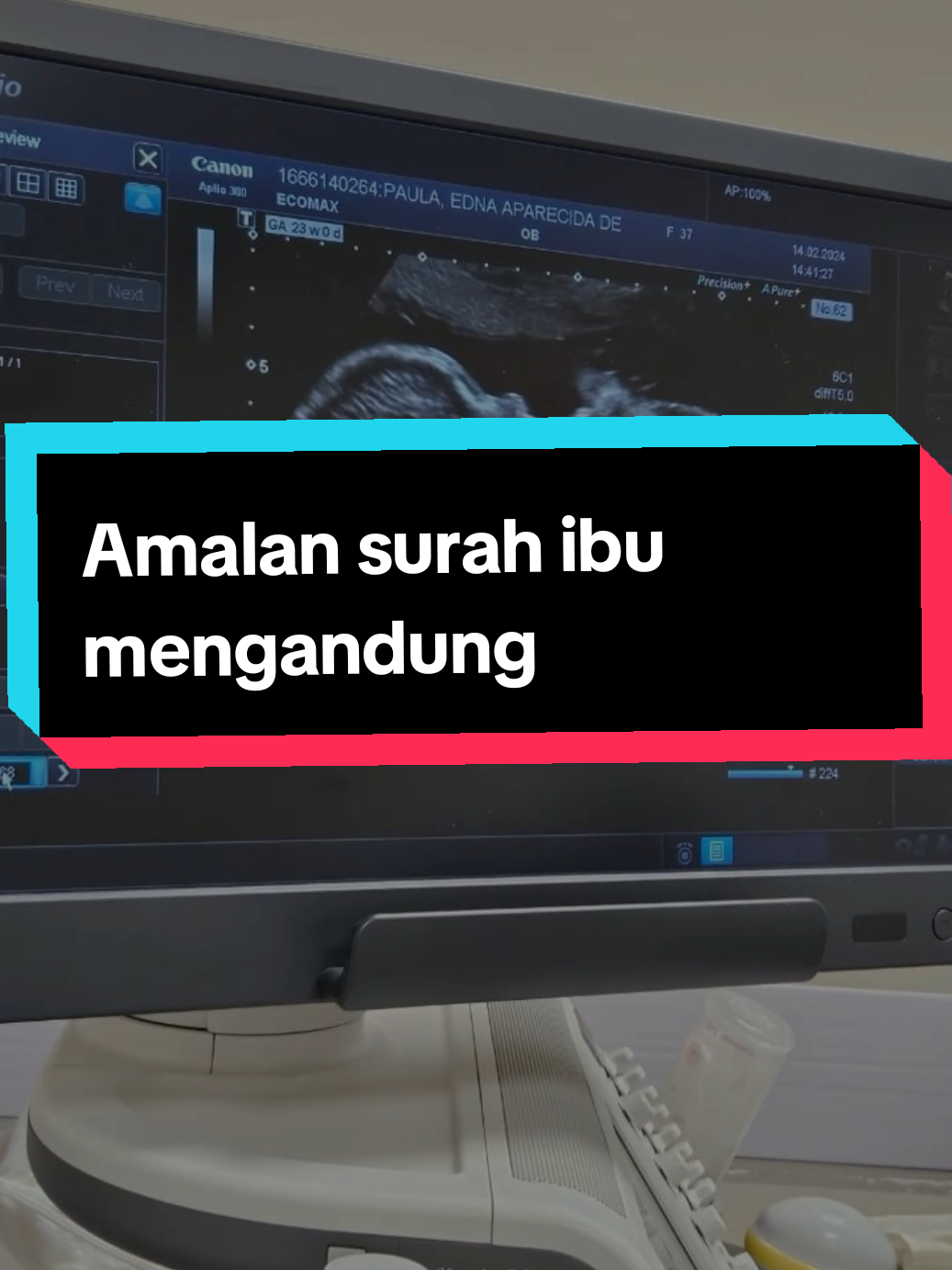 Amalan surah maryam ayat 30-35 semoga anak lahir soleh solehah #tipsibumengandung #amalanibumengandung #doa #surahmaryam #CapCut 