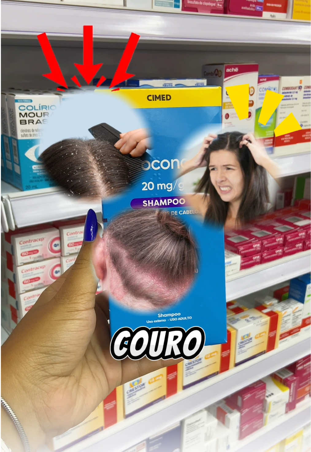 Cetoconazol é um antifúngico indicado para o tratamento de infecções causadas por fungos, como dermatite seborreica, caspa, candidíase oral ou vaginal, ou infecções pulmonares como blastomicose ou histoplasmose, por exemplo…😱🤩💊 #foryou #foryoupage❤️❤️ #viral #viralvideos #trend 