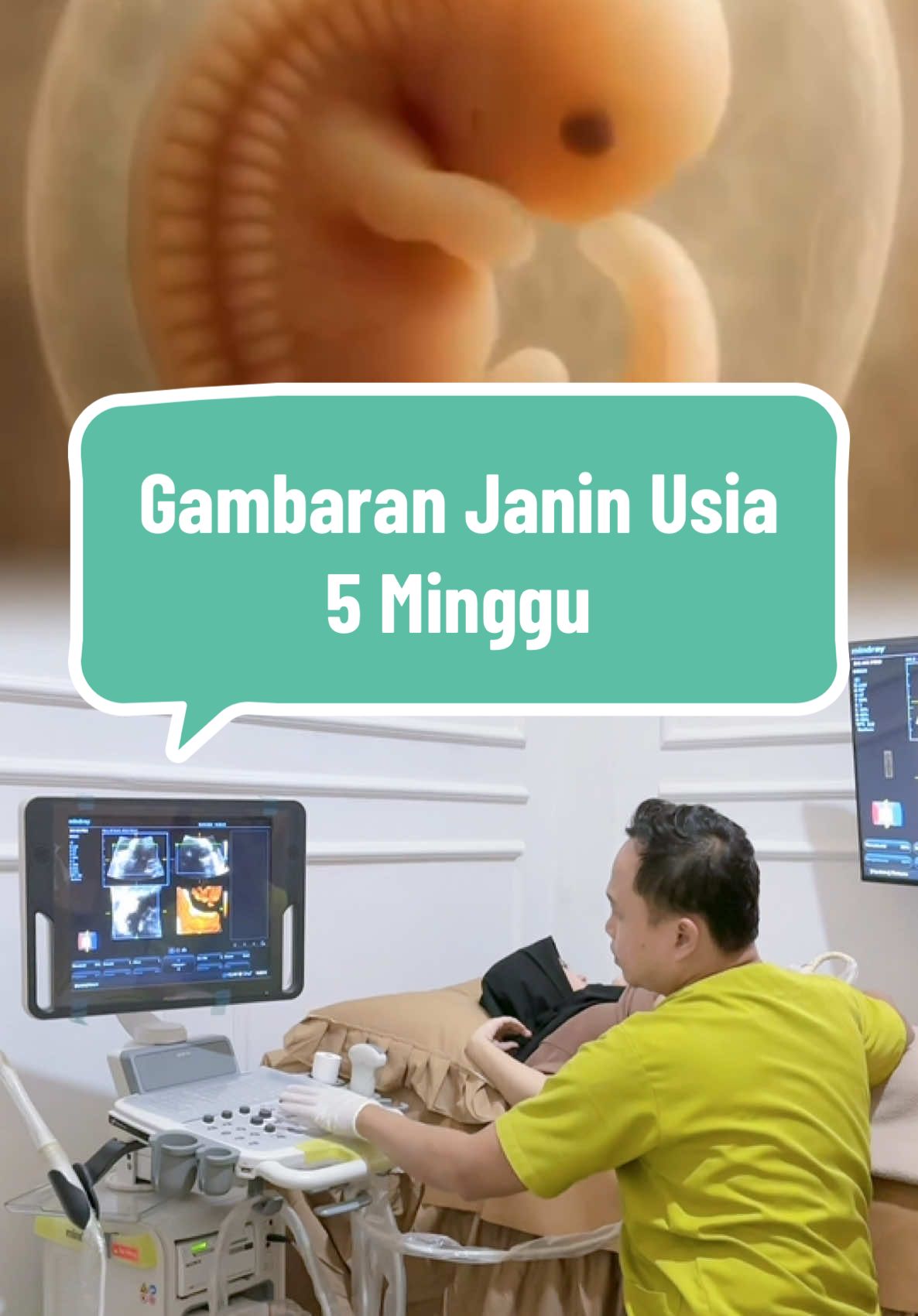Gambaran janin usia 5 minggu.. #fyp #dokterkandungan #doa #usg #5weeks 