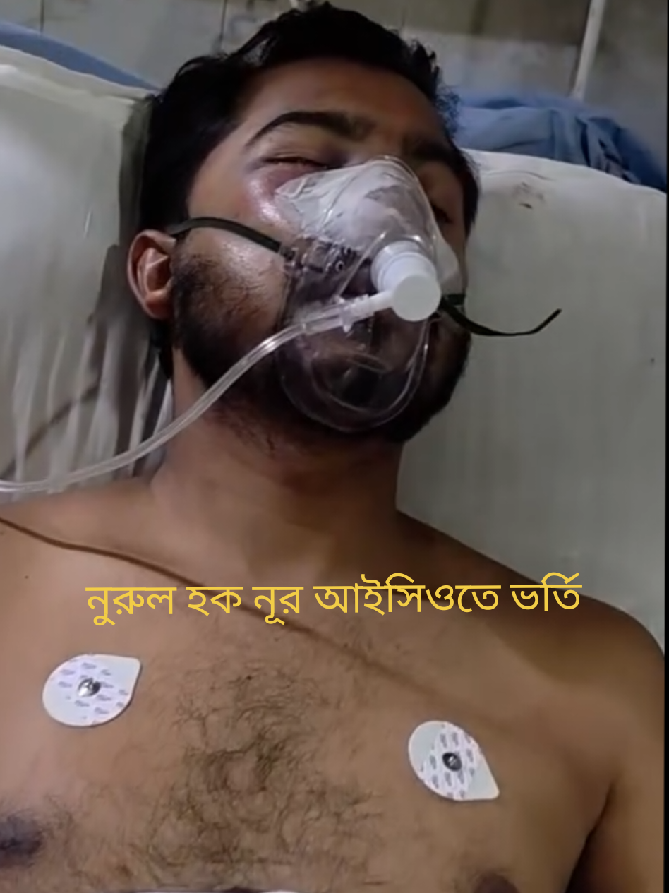 নুরুল হক নুর গুরুতর অসুস্থ আইসিইউতে ভর্তি  কি রাজনীতি ভাই 