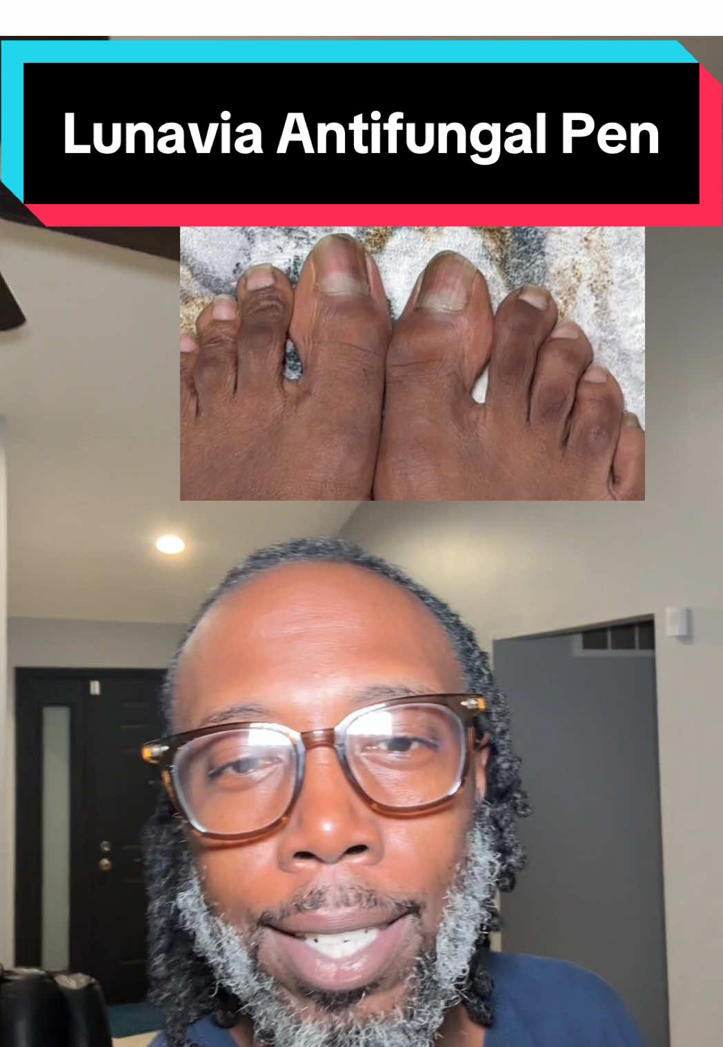 Replying to @Franswigg Here go the receipts this works 💯  #TikTokShopCreatorPicks #toefungus #HealthMustHaves #Pedicure #tiktokshoplaborday 