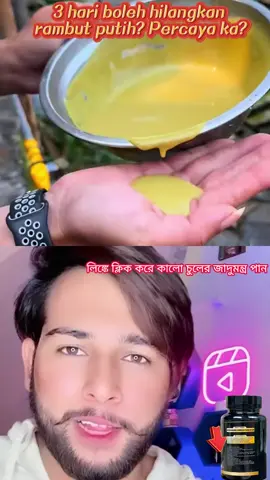 8.30 yxw ML hfwsp.💥 Rambut beruban di bahagian atas epala⁉ Akar rambut beruban⁉ Kehilangan seikat rambut ketika menyikat rambut⁉ 👉 Cuba suplemen rambut hitam ini sekarang 🧐 [Sangat disyorkan oleh pakar] 👍 Mengandungi ekstrak herba seperti mulberi hitam, serigala hitam, beras hitam, habbatus sauda dan bahan-bahan semula jadi 💯 Sasaran rambut 💯 ively memulihkan rambut hitam ✅ Mengembalikan kilauan muda anda 🌈 🥰 Hasil dapat dilihat dalam tujuh hari Search Malaysia tiktok Mall: Balance and Wellness Center Search the store name to buy-635696
