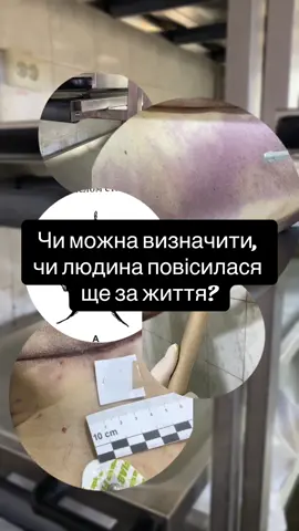 Привіт! Я — судово-медичний експерт, і в мене для вас новина. 1 вересня о 19:00 я проведу свій перший прямий ефір тут, у TikTok! Хочете дізнатися більше про роботу судмедексперта? 👨‍⚕️💀#судовомедичнаекспертиза #судмедексперт #forensics #тілоякдоказ #судмедекспертиза 